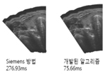 simens 방법 276.93ms, 개발된 알고리즘 75.66ms